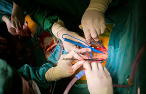 Surgery Superior to Medical Therapy for Severe Heart Disease